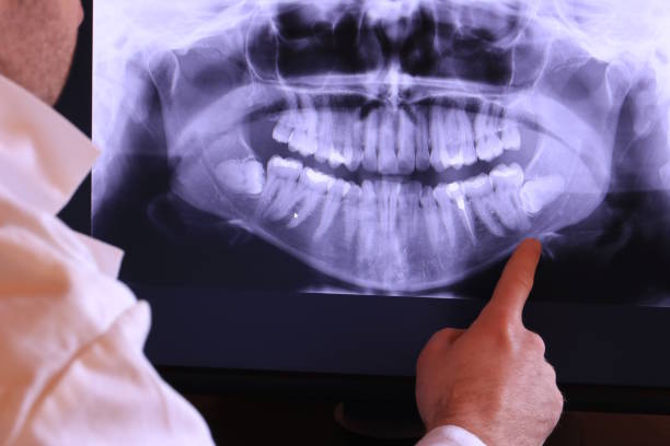Best Emergency Treatment for Dental Infections or Abscesses in Columbus Junction, IA